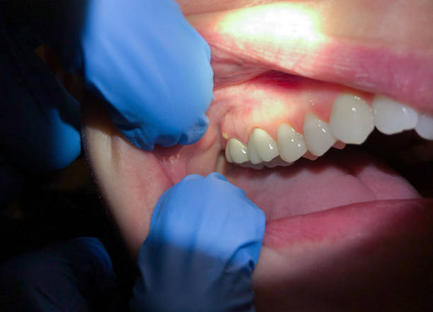 Best Cosmetic Emergency Dentistry in The Dalles, OR